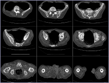 Ctscan